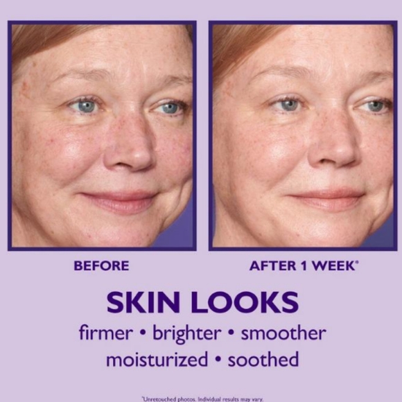 PETER THOMAS ROTH ULTIMATE SOLUTION 5 MULTI-TASKING MOISTURIZER 5-IN-1 TREATMENT - Picture 6 of 11